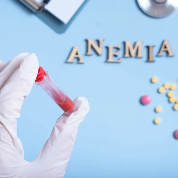 A hand gripping a blood test tube marked 'anemia' on a blue backdrop, representing the significance of iron-deficiency anemia.